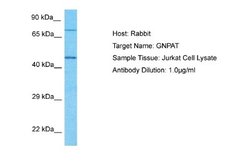 GNPAT Rabbit anti-Human, Polyclonal, Novus Biologicals 0.1ml; Unconjugated:Antibodies,